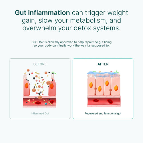 Body Protection Compound (BPC-157)