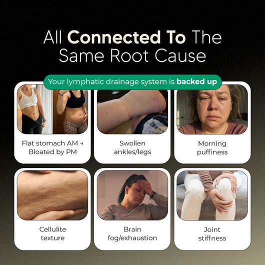 Lymphatic Drainage Capsules